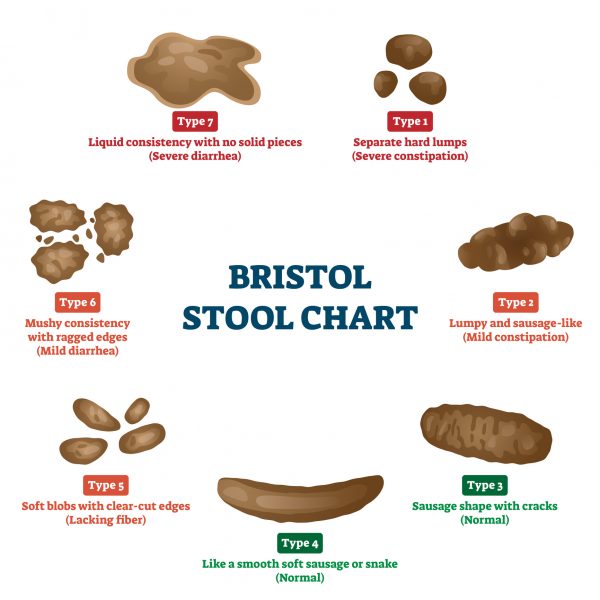Bristol stool chart tool for faeces type classification vector illustration. Anatomical medicine diagnostic method for patient abdomen problems. Constipation and diarrhea digestive division scheme.